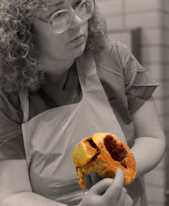 Doris circa 1993 teaching; Pathologists' Assistant Locum Tenens by Doris Schuler-Maloney, M.S., PA(ASCP)